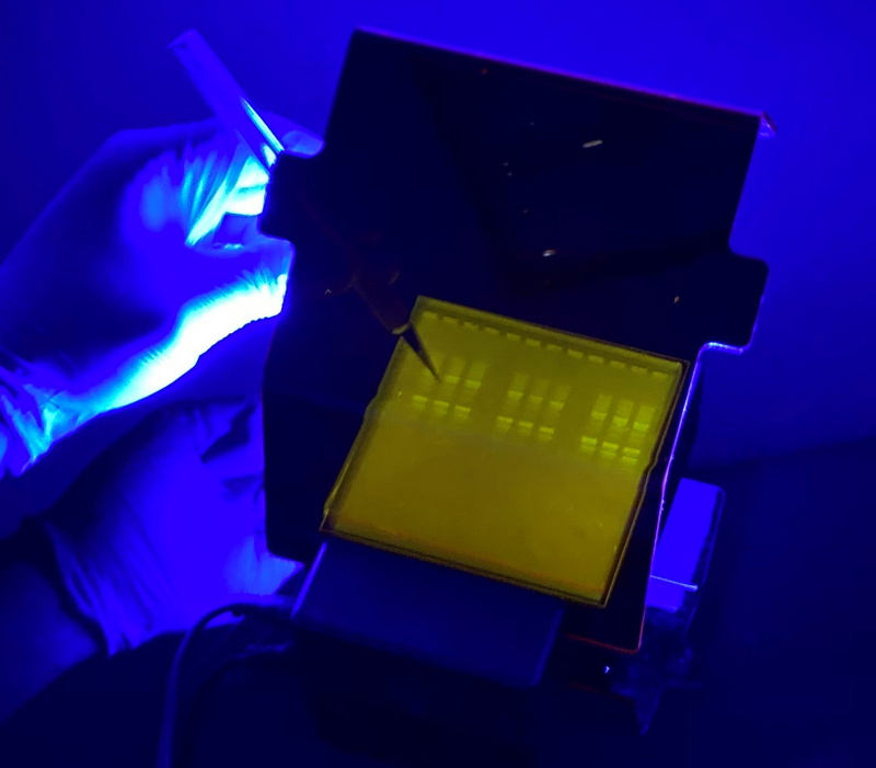 Band excision using an Accuris SmartBlue Mini blue light transillumiator